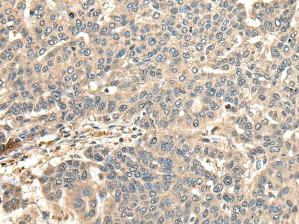 Rabbit Polyclonal Antibody to CCDC113