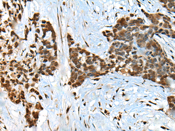 Rabbit Polyclonal Antibody to CCDC12