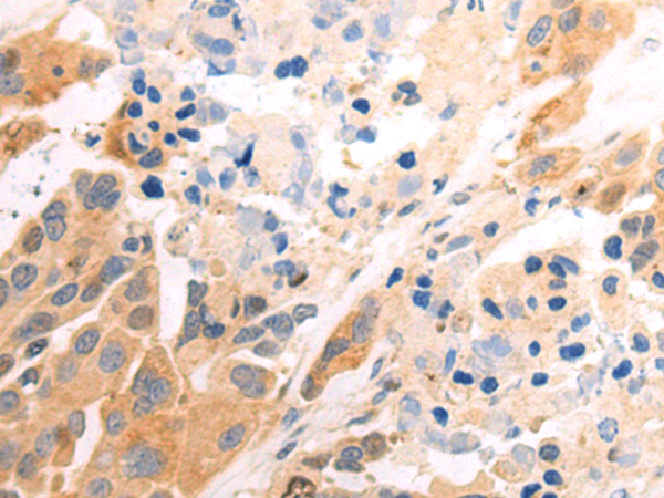Rabbit Polyclonal Antibody to CCDC120
