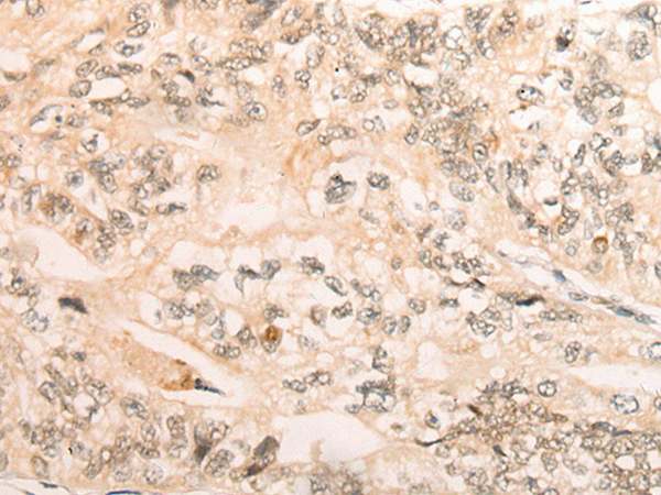 Rabbit Polyclonal Antibody to ABRAXAS1