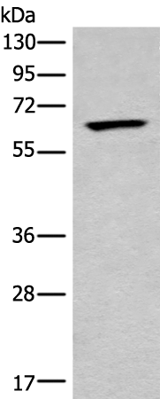 Rabbit Polyclonal Antibody to CCT6B