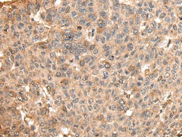 Rabbit Polyclonal Antibody to HMMR