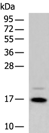 Rabbit Polyclonal Antibody to CD247