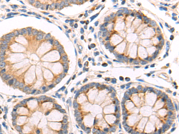 Rabbit Polyclonal Antibody to ST6GAL1