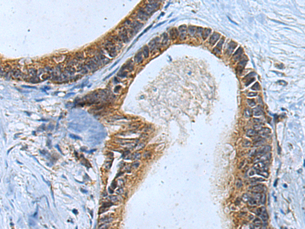 Rabbit Polyclonal Antibody to CD83