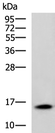 Rabbit Polyclonal Antibody to CDA