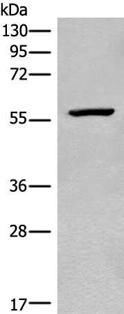 Rabbit Polyclonal Antibody to CDADC1