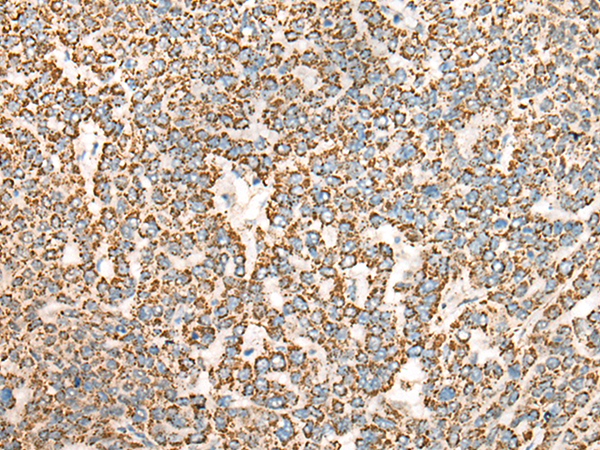 Rabbit Polyclonal Antibody to CDC42EP2