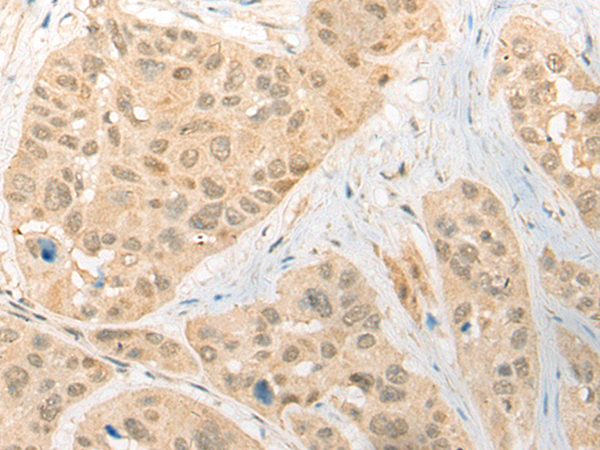 Rabbit Polyclonal Antibody to CDCA4