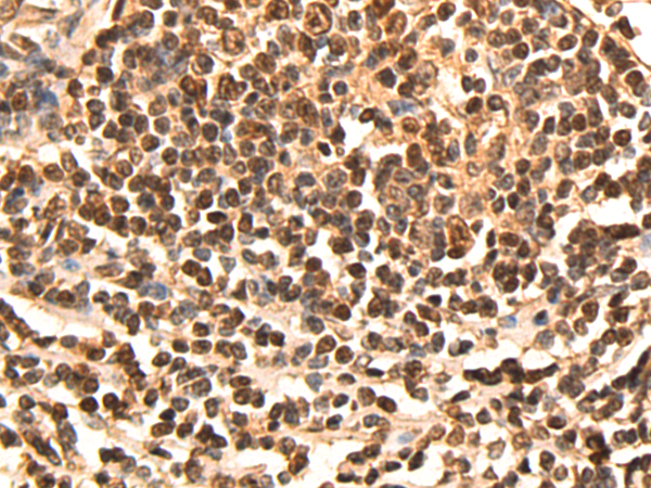 Rabbit Polyclonal Antibody to CDCA5