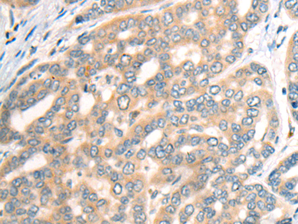 Rabbit Polyclonal Antibody to CDH19