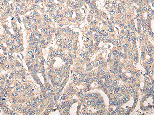 Rabbit Polyclonal Antibody to CDK2AP2