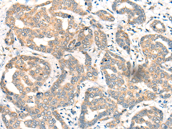 Rabbit Polyclonal Antibody to CDK2AP1