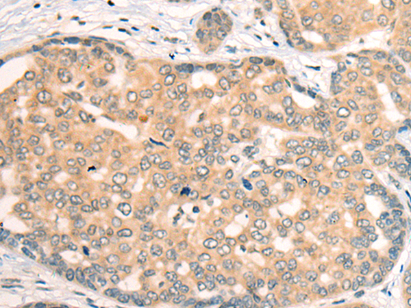 Rabbit Polyclonal Antibody to CDKAL1