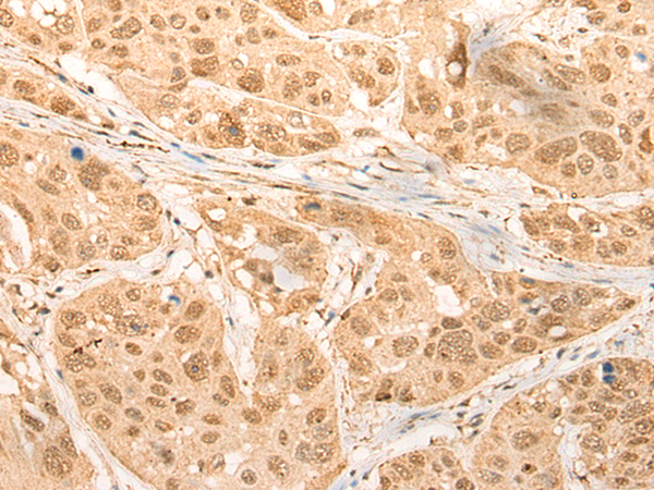 Rabbit Polyclonal Antibody to CDKN2AIPNL