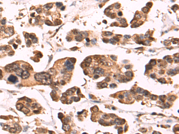 Rabbit Polyclonal Antibody to DTL