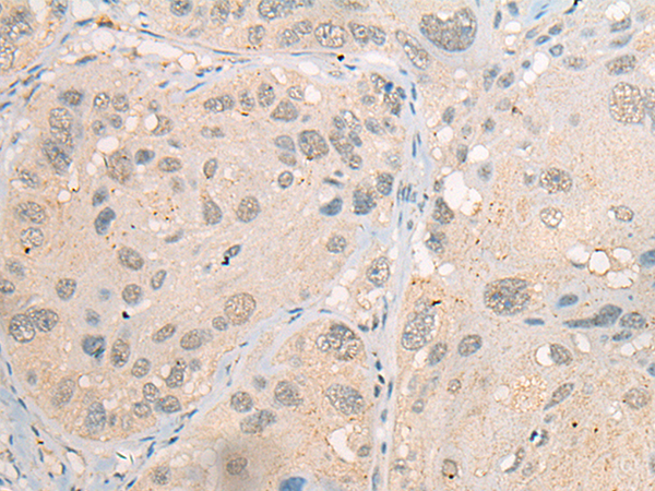 Rabbit Polyclonal Antibody to CDYL2