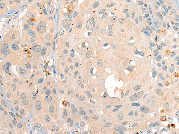 Rabbit Polyclonal Antibody to ADA2