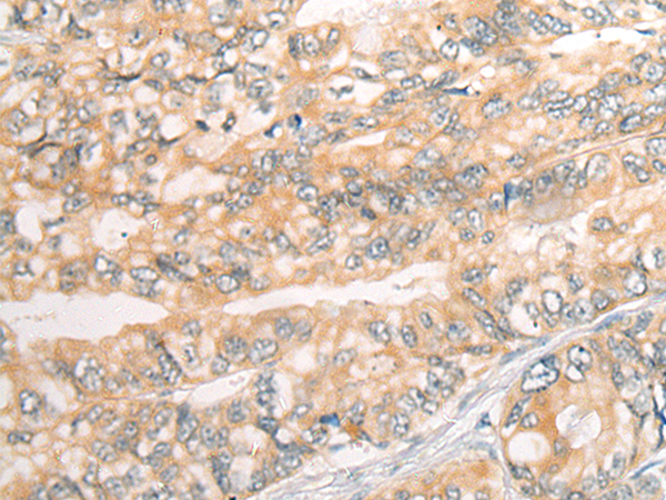 Rabbit Polyclonal Antibody to ADAP1