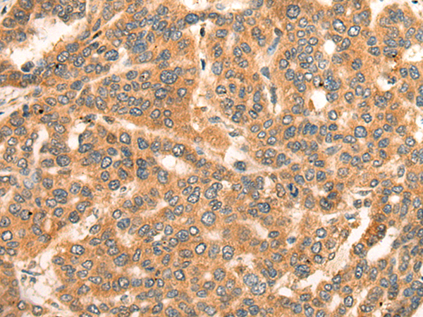 Rabbit Polyclonal Antibody to ADAP2