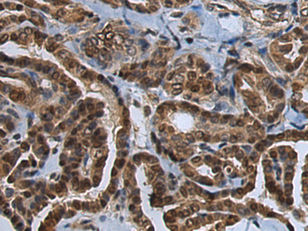 Rabbit Polyclonal Antibody to CETN2