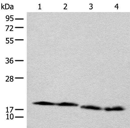 Rabbit Polyclonal Antibody to CETN3