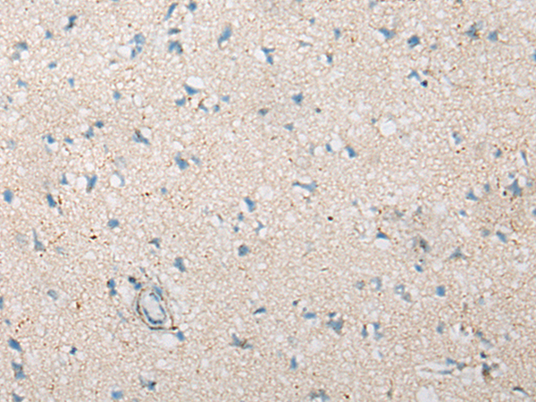 Rabbit Polyclonal Antibody to CEP70