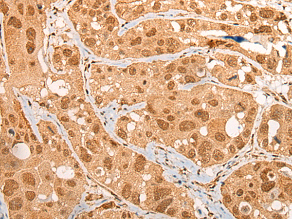 Rabbit Polyclonal Antibody to CEP290