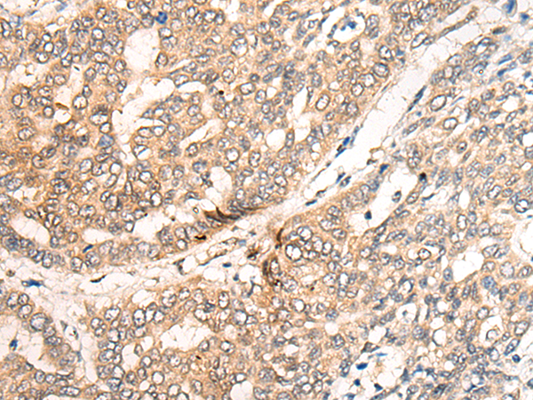 Rabbit Polyclonal Antibody to CER1