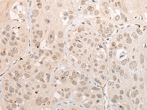 Rabbit Polyclonal Antibody to DPF3