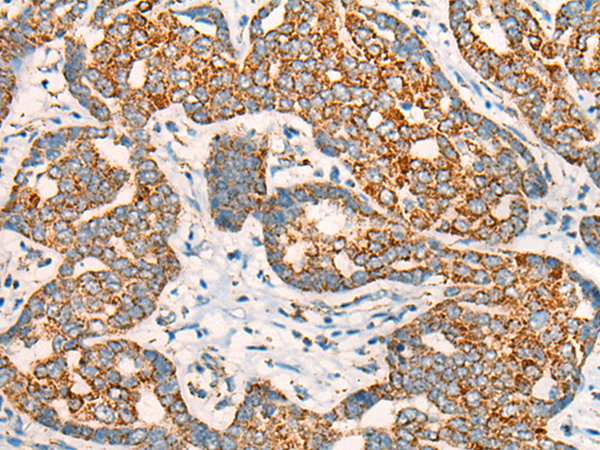 Rabbit Polyclonal Antibody to CCT8L2