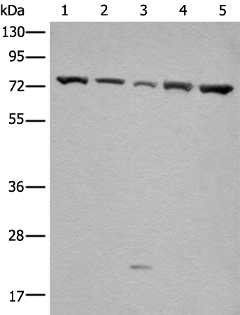 Rabbit Polyclonal Antibody to GARS1