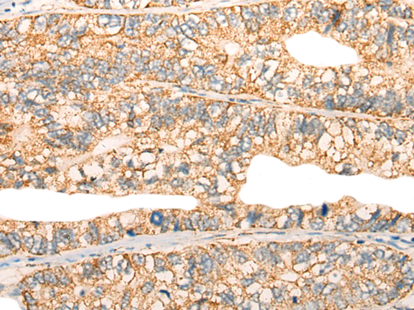 Rabbit Polyclonal Antibody to CFHR2