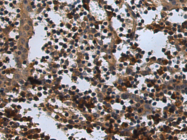 Rabbit Polyclonal Antibody to CXXC1