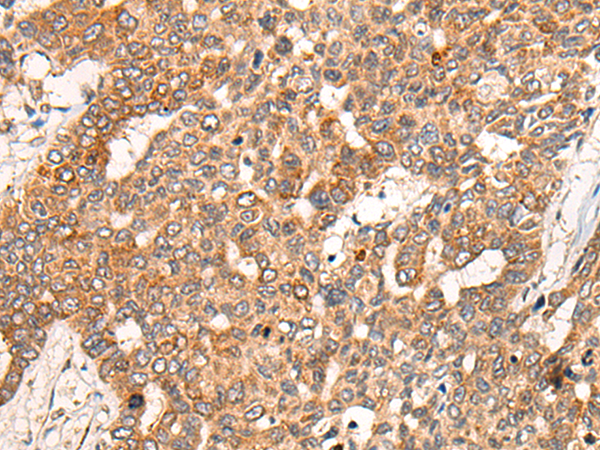 Rabbit Polyclonal Antibody to CGREF1
