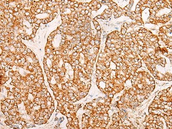 Rabbit Polyclonal Antibody to CHAC2
