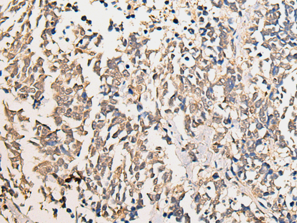 Rabbit Polyclonal Antibody to CHD2