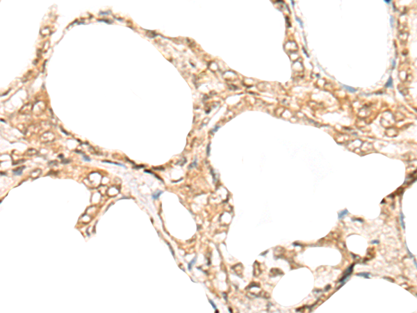 Rabbit Polyclonal Antibody to CHERP