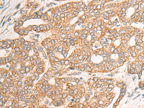 Rabbit Polyclonal Antibody to CHI3L2