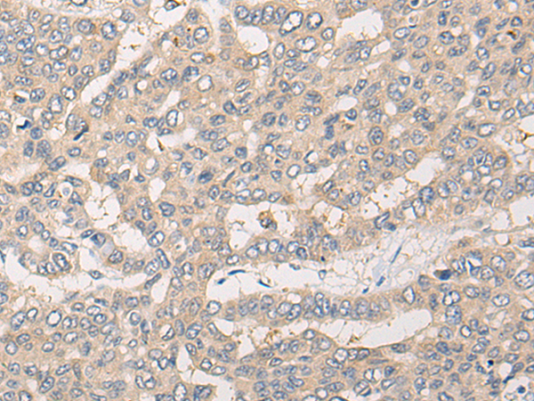 Rabbit Polyclonal Antibody to CLCN5