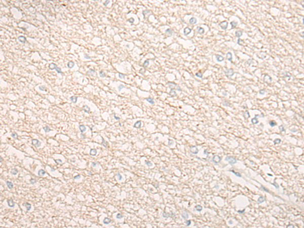 Rabbit Polyclonal Antibody to CHMP2B