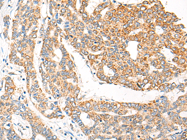 Rabbit Polyclonal Antibody to CHMP5