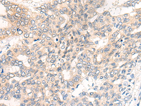 Rabbit Polyclonal Antibody to CHRD