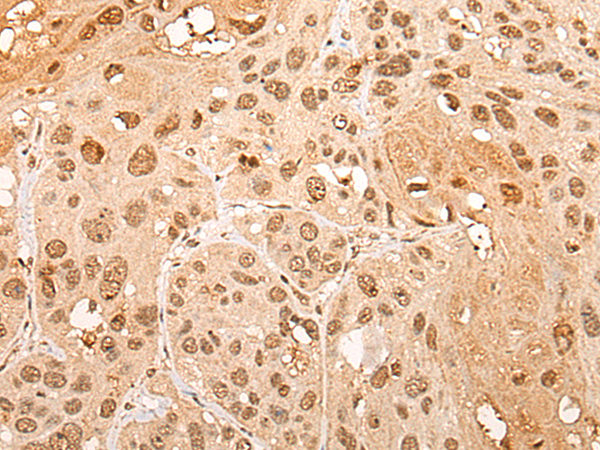 Rabbit Polyclonal Antibody to CHRAC1