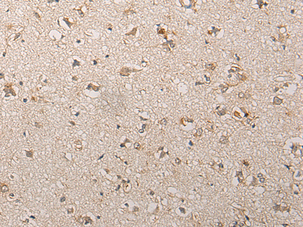 Rabbit Polyclonal Antibody to CHST10