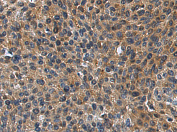 Rabbit Polyclonal Antibody to CTRC