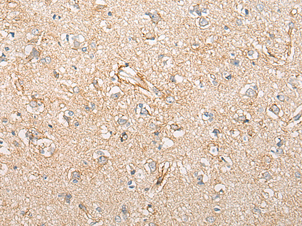 Rabbit Polyclonal Antibody to CIAO1