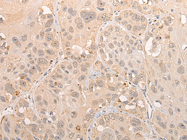 Rabbit Polyclonal Antibody to CINP