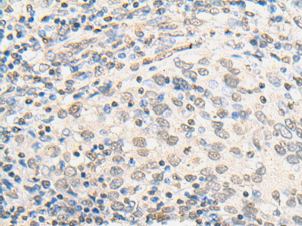 Rabbit Polyclonal Antibody to CIRBP