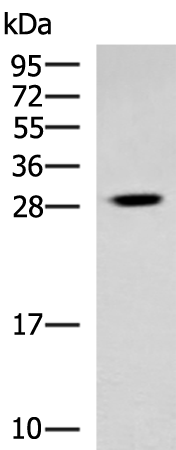 Rabbit Polyclonal Antibody to TBCB